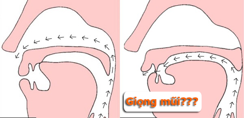 Giọng mũi là gì